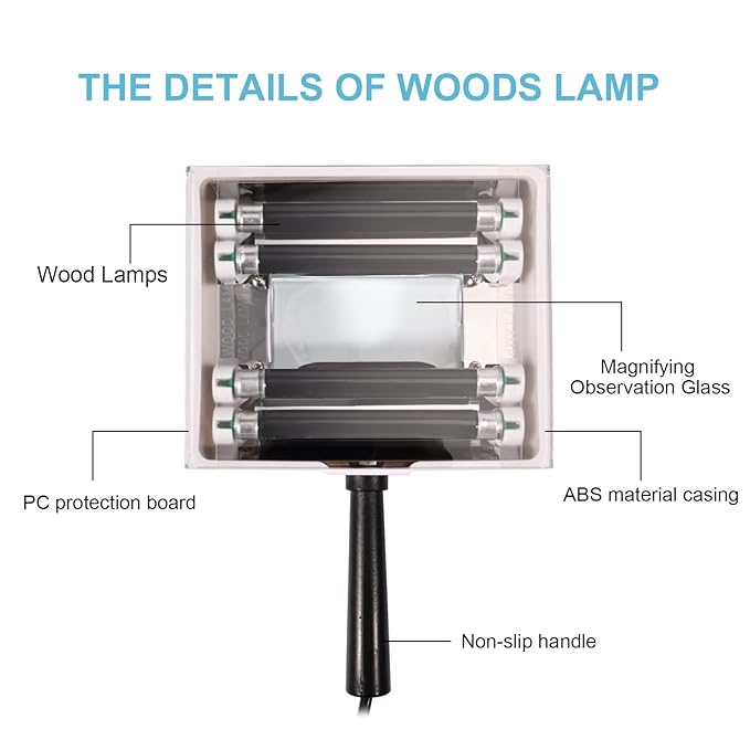 Woods Lamp Skin Analyzer, Magnifying Analyzer Beauty Test Face Care, Wood Lamp,Gifts SPA Machine Salon Equipment, Home Salon Machine for Facial Care Pet Dogs Cats Urine