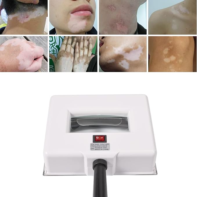 Woods Lamp Skin Analyzer, Magnifying Analyzer Beauty Test Face Care, Wood Lamp,Gifts SPA Machine Salon Equipment, Home Salon Machine for Facial Care Pet Dogs Cats Urine