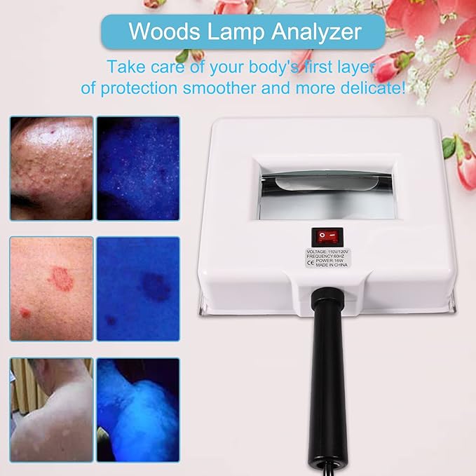 Woods Lamp Skin Analyzer, Magnifying Analyzer Beauty Test Face Care, Wood Lamp,Gifts SPA Machine Salon Equipment, Home Salon Machine for Facial Care Pet Dogs Cats Urine